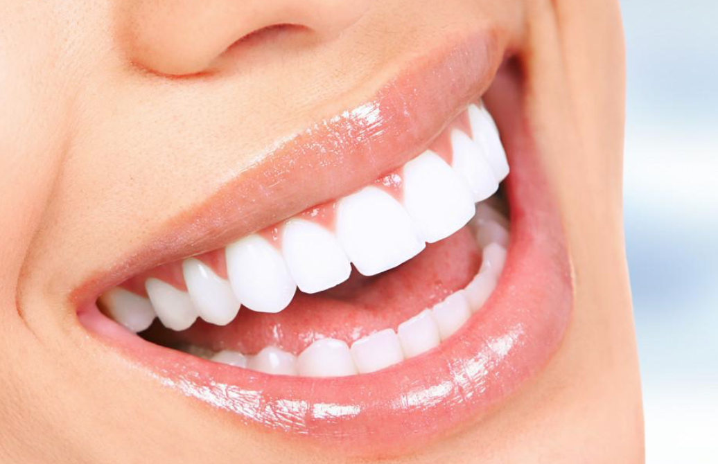 Teeth Whitening